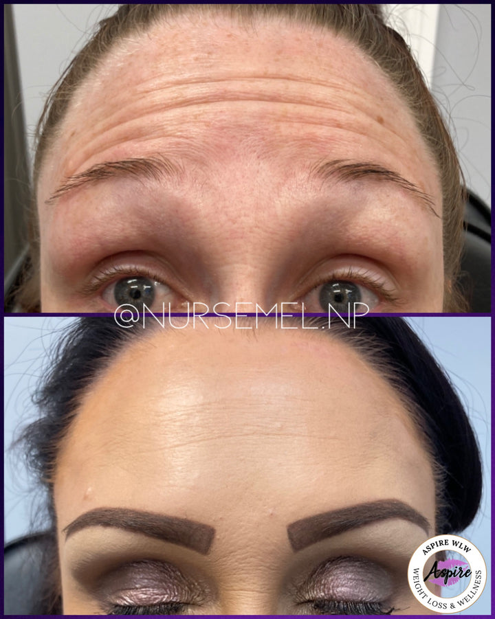 VIP Botox Membership