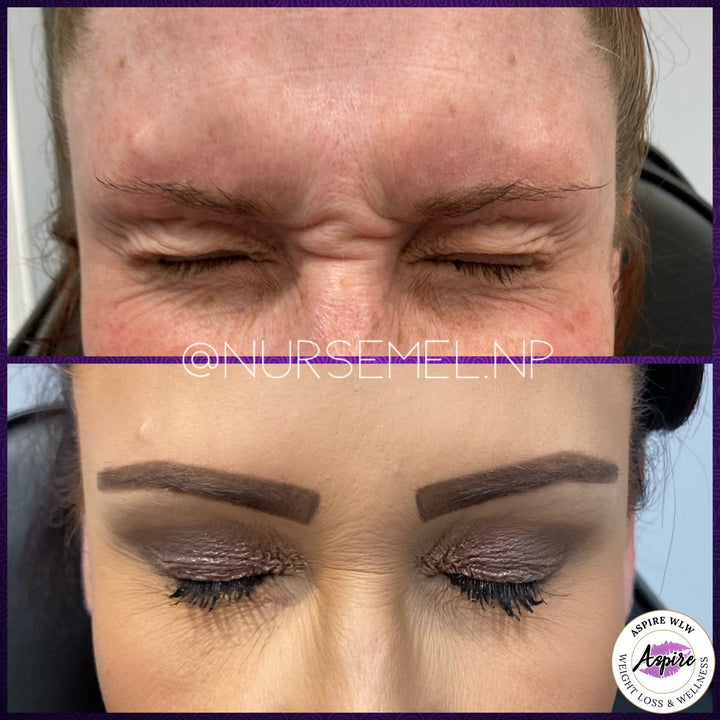 VIP Botox Membership